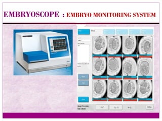 EMBRYOSCOPE : EMBRYO MONITORING SYSTEM
 