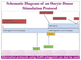 Schematic Diagram of an Oocyte Donor
Stimulation Protocol
Alternative protocols using GnRH antagonist can also be used
 
