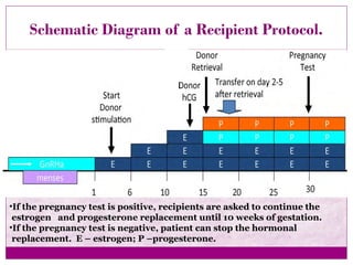 Schematic Diagram of a Recipient Protocol.
•If the pregnancy test is positive, recipients are asked to continue the
estrogen and progesterone replacement until 10 weeks of gestation.
•If the pregnancy test is negative, patient can stop the hormonal
replacement. E – estrogen; P –progesterone.
 