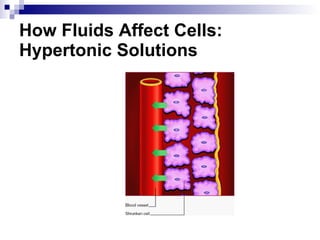 How Fluids Affect Cells: Hypertonic Solutions 