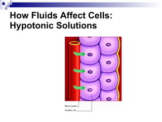 How Fluids Affect Cells: Hypotonic Solutions 