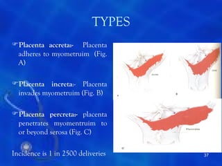 TYPES
Placenta accreta:- Placenta
 adheres to myometruim (Fig.
 A)

Placenta increta:- Placenta
 invades myometruim (Fig. B)

Placenta percreta:- placenta
 penetrates myomentruim to
 or beyond serosa (Fig. C)

Incidence is 1 in 2500 deliveries   37
 