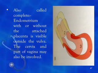 •   Also          called
    complete:-
    Endometrium
    with or without
    the        attached
    placenta is visible
    outside the vulva.
    The cervix and
    part of vagina may
    also be involved.

                           47
 