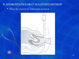 II. HYDROSTATICS OR O’ SULLIVAN’S METHOD
   Place the patient in lithotomy position




                                              57
 