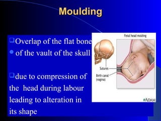 Positional Molding thirdstageoflaborforundergraduate-130306091350-phpapp01 (1).pdf