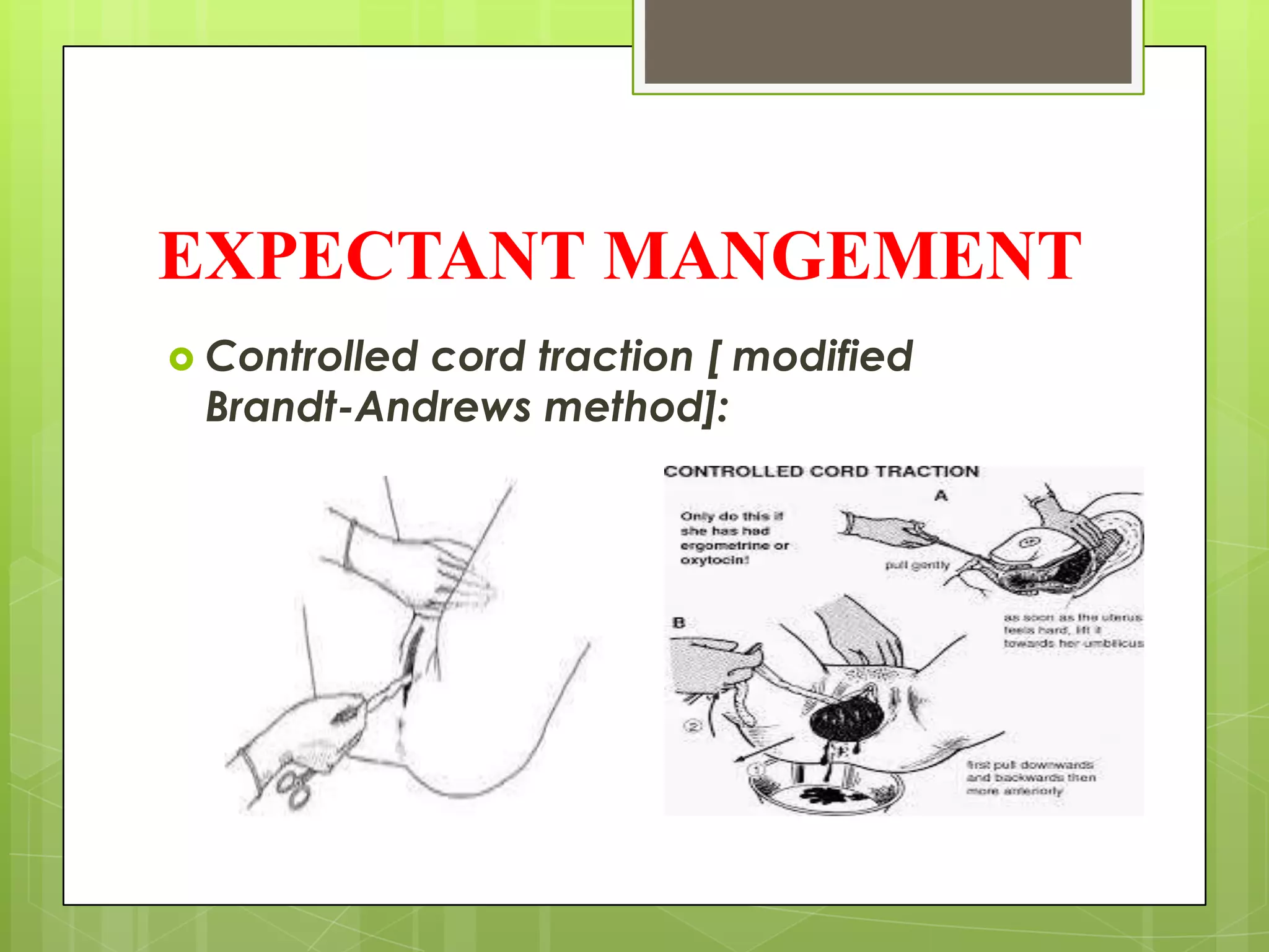 EXPECTANT MANGEMENT
 Controlled cord traction [ modified
Brandt-Andrews method]:
 