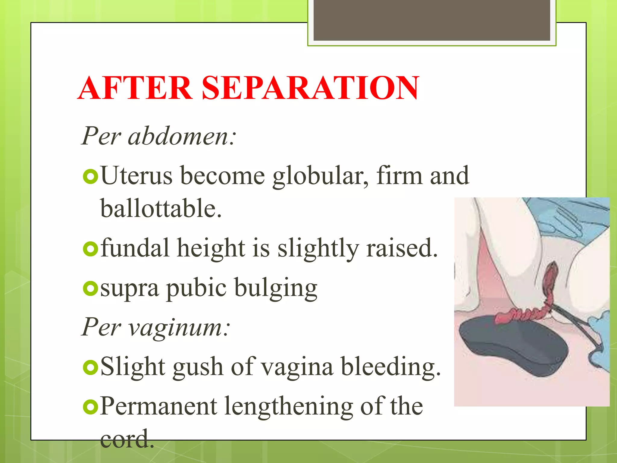 AFTER SEPARATION
Per abdomen:
Uterus become globular, firm and
ballottable.
fundal height is slightly raised.
supra pubic bulging
Per vaginum:
Slight gush of vagina bleeding.
Permanent lengthening of the
cord.
 