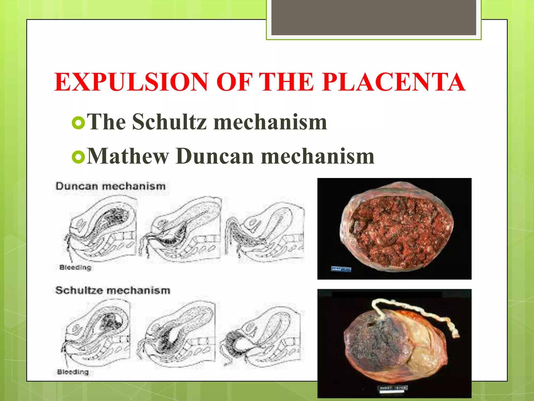 EXPULSION OF THE PLACENTA
The Schultz mechanism
Mathew Duncan mechanism
 