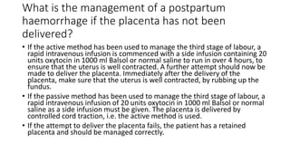 Balsol Third stage of labour.pdf