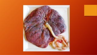 Third stage of labour.pdf