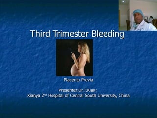 Third Trimester Bleeding Placenta Previa Presenter:Dr.T.Kiak:  Xianya 2 nd  Hospital of Central South University, China 