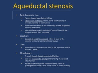 Aqueductal stenosis
• Best diagnostic clue
• Funnel-shaped aqueduct of Sylvius
• "Ballooned" ventricles (lateral, third) and foramina of
Monroe proximal to obstruction
• Normal fourth ventricle and foramina (Luschka, Magendie)
distal to obstruction
• Interstitial edema with indistinct ("blurred") ventricular
margins (absent if AS "arrested")
• Location:
• Stenosis at cerebral aqueduct, either at level of the
superior colliculi or at intercollicular sulcus
• Size:
• Normal mean cross-sectional area of the aqueduct at birth
is 0.2 to 1.8 mm2
• Morphology
• Typically funnel-shaped aqueduct of Sylvius
• May see "aqueductal forking" or branching of aqueduct
into channels
• Aqueductal forking often accompanied by fusion of
quadrigeminal bodies, third nerve nuclei or tectal beaking
 