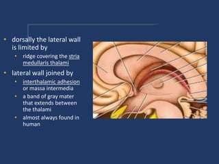 • dorsally the lateral wall
is limited by
• ridge covering the stria
medullaris thalami
• lateral wall joined by
• interthalamic adhesion
or massa intermedia
• a band of gray mater
that extends between
the thalami
• almost always found in
human
 