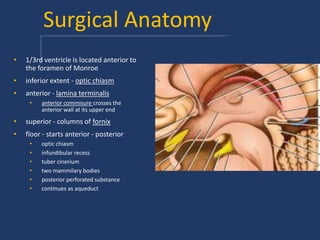 Surgical Anatomy
• 1/3rd ventricle is located anterior to
the foramen of Monroe
• inferior extent - optic chiasm
• anterior - lamina terminalis
• anterior commisure crosses the
anterior wall at its upper end
• superior - columns of fornix
• floor - starts anterior - posterior
• optic chiasm
• infundibular recess
• tuber cinerium
• two mammilary bodies
• posterior perforated substance
• continues as aqueduct
 