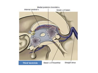 Third Ventricle
 