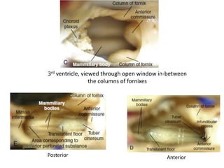 3rd ventricle, viewed through open window in-between
the columns of fornixes
AnteriorPosterior
 