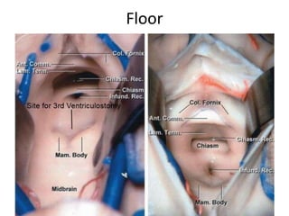 Floor
 