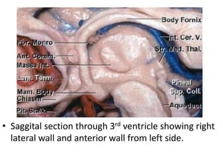 • Saggital section through 3rd ventricle showing right
lateral wall and anterior wall from left side.
 