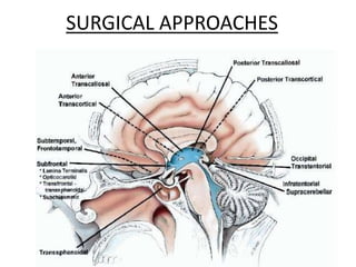 SURGICAL APPROACHES
 
