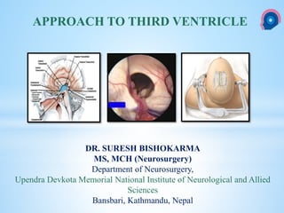 cka
DR. SURESH BISHOKARMA
MS, MCH (Neurosurgery)
Department of Neurosurgery,
Upendra Devkota Memorial National Institute of Neurological and Allied
Sciences
Bansbari, Kathmandu, Nepal
APPROACH TO THIRD VENTRICLE
 