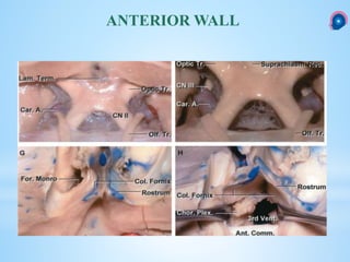 ANTERIOR WALL
 