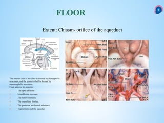 FLOOR
Extent: Chiasm- orifice of the aqueduct
The anterior half of the floor is formed by diencephalic
structures, and the posterior half is formed by
mesencephalic structures.
From anterior to posterior
1. The optic chiasma
2. Infundibular recesses,
3. The tuber cinereum,
4. The mamillary bodies,
5. The posterior perforated substance
6. Tegmentum and the aqueduct
 