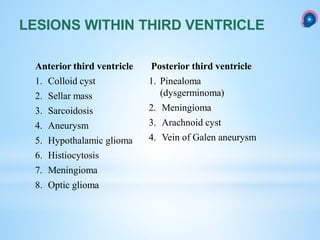 LESIONS WITHIN THIRD VENTRICLE
Anterior third ventricle
1. Colloid cyst
2. Sellar mass
3. Sarcoidosis
4. Aneurysm
5. Hypothalamic glioma
6. Histiocytosis
7. Meningioma
8. Optic glioma
Posterior third ventricle
1. Pinealoma
(dysgerminoma)
2. Meningioma
3. Arachnoid cyst
4. Vein of Galen aneurysm
 