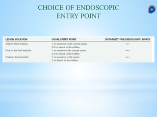 CHOICE OF ENDOSCOPIC
ENTRY POINT
 