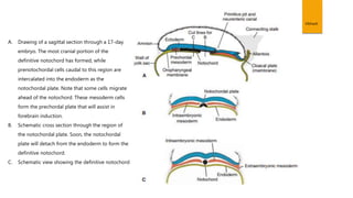 Vibhash
A. Drawing of a sagittal section through a 17-day
embryo. The most cranial portion of the
definitive notochord has formed, while
prenotochordal cells caudal to this region are
intercalated into the endoderm as the
notochordal plate. Note that some cells migrate
ahead of the notochord. These mesoderm cells
form the prechordal plate that will assist in
forebrain induction.
B. Schematic cross section through the region of
the notochordal plate. Soon, the notochordal
plate will detach from the endoderm to form the
definitive notochord.
C. Schematic view showing the definitive notochord
 