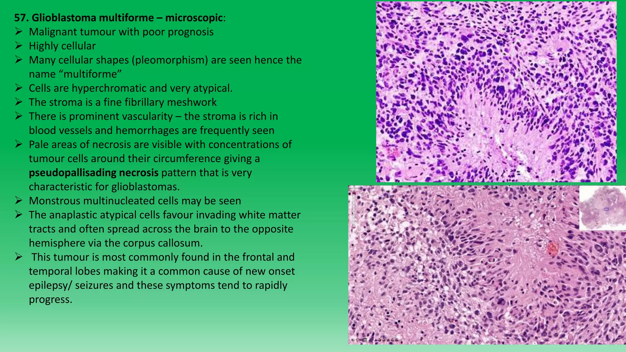 PMU third/fourth year Clinical pathoanatomy Part 2 | PPTX