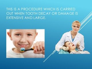 THIS IS A PROCEDURE WHICH IS CARRIED
OUT WHEN TOOTH DECAY OR DAMAGE IS
EXTENSIVE AND LARGE.
 