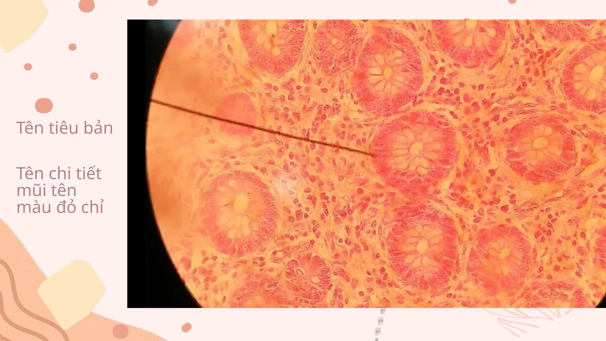 Đề thi thử chạy trạm mô phôi đại học y.pptx