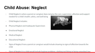 Child Abuse: Neglect
- Child Neglect is when a parent or caregiver does not give the care, supervision, affection and support
needed for a child’s health, safety, and well being
- Child Neglect includes:
● Physical Neglect and Inadequate Supervision
● Emotional Neglect
● Medical Neglect
● Educational Neglect
- Signs of Neglect from a parent or caregiver would include showing no signs of affection towards the
child
- Signs of Neglect in a child would include hygiene problems, clothing not fitting or being unwashed, low
 