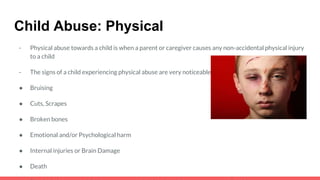 Child Abuse: Physical
- Physical abuse towards a child is when a parent or caregiver causes any non-accidental physical injury
to a child
- The signs of a child experiencing physical abuse are very noticeable
● Bruising
● Cuts, Scrapes
● Broken bones
● Emotional and/or Psychological harm
● Internal injuries or Brain Damage
● Death
 