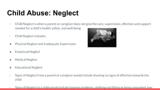 Child Abuse: Neglect
- Child Neglect is when a parent or caregiver does not give the care, supervision, affection and support
needed for a child’s health, safety, and well being
- Child Neglect includes:
● Physical Neglect and Inadequate Supervision
● Emotional Neglect
● Medical Neglect
● Educational Neglect
- Signs of Neglect from a parent or caregiver would include showing no signs of affection towards the
child
- Signs of Neglect in a child would include hygiene problems, clothing not fitting or being unwashed, low
 
