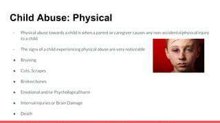 Child Abuse: Physical
- Physical abuse towards a child is when a parent or caregiver causes any non-accidental physical injury
to a child
- The signs of a child experiencing physical abuse are very noticeable
● Bruising
● Cuts, Scrapes
● Broken bones
● Emotional and/or Psychological harm
● Internal injuries or Brain Damage
● Death
 