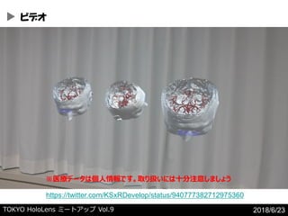 TOKYO HoloLens ߩ`ȥå Vol.9 2018/6/23
ӥǥ
https://twitter.com/KSxRDevelop/status/940777382712975360
ҽǩ`ςǤȡQˤʮע⤷ޤ礦
 