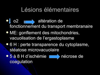 Lésions élémentaires
   o2           altération de
  fonctionnement du transport membranaire
 ME: gonflement des mitochondries,
  vacuolisation de l’ergastoplasme
 6 H : perte transparence du cytoplasme,
  stéatose microvacuolaire
 5 à 8 H d’ischémie         nécrose de
  coagulation
 