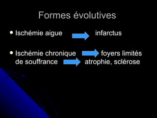 Formes évolutives
   Ischémie aigue          infarctus

   Ischémie chronique        foyers limités
    de souffrance        atrophie, sclérose
 