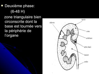    Deuxième phase:
        (6-48 H)
    zone triangulaire bien
    circonscrite dont la
    base est tournée vers
    la périphérie de
    l’organe
 