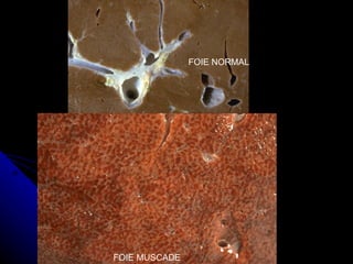 FOIE NORMAL




FOIE MUSCADE
 