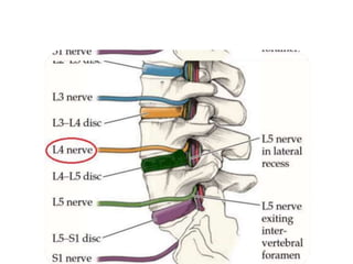 THOAT-VI-ĐĨA-ĐỆM-ĐAU-TK-TỌA.pptx. nttu.......