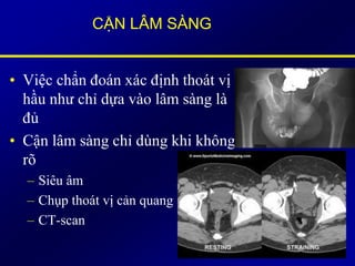 CẬN LÂM SÀNG
• Việc chẩn đoán xác định thoát vị
hầu như chỉ dựa vào lâm sàng là
đủ
• Cận lâm sàng chỉ dùng khi không
rõ
– Siêu âm
– Chụp thoát vị cản quang
– CT-scan
 