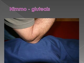 Buttler Never FlossingMyofascial Release Tech     Active Release Tech ®Postisolation Relaxation