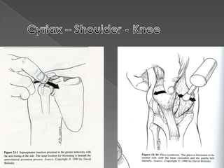Acu-Force – forearm flexors