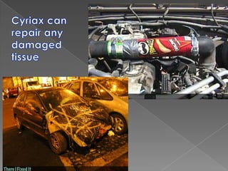 Acu-Force – lumbar spine