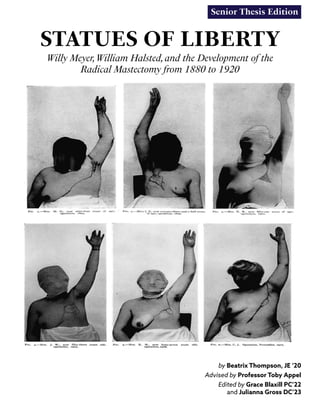 STATUES OF LIBERTY
Willy Meyer,William Halsted,and the Development of the
Radical Mastectomy from 1880 to 1920
Senior Thesis Edition
by Beatrix Thompson, JE ‘20
Advised by Professor Toby Appel
Edited by Grace Blaxill PC’22
and Julianna Gross DC’23
 