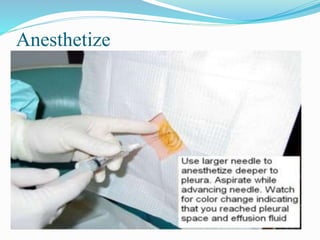 Anesthetize
 