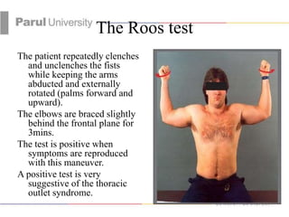 Roos Testing THORACIC%20OUTLET%20SYNDROME.pptx