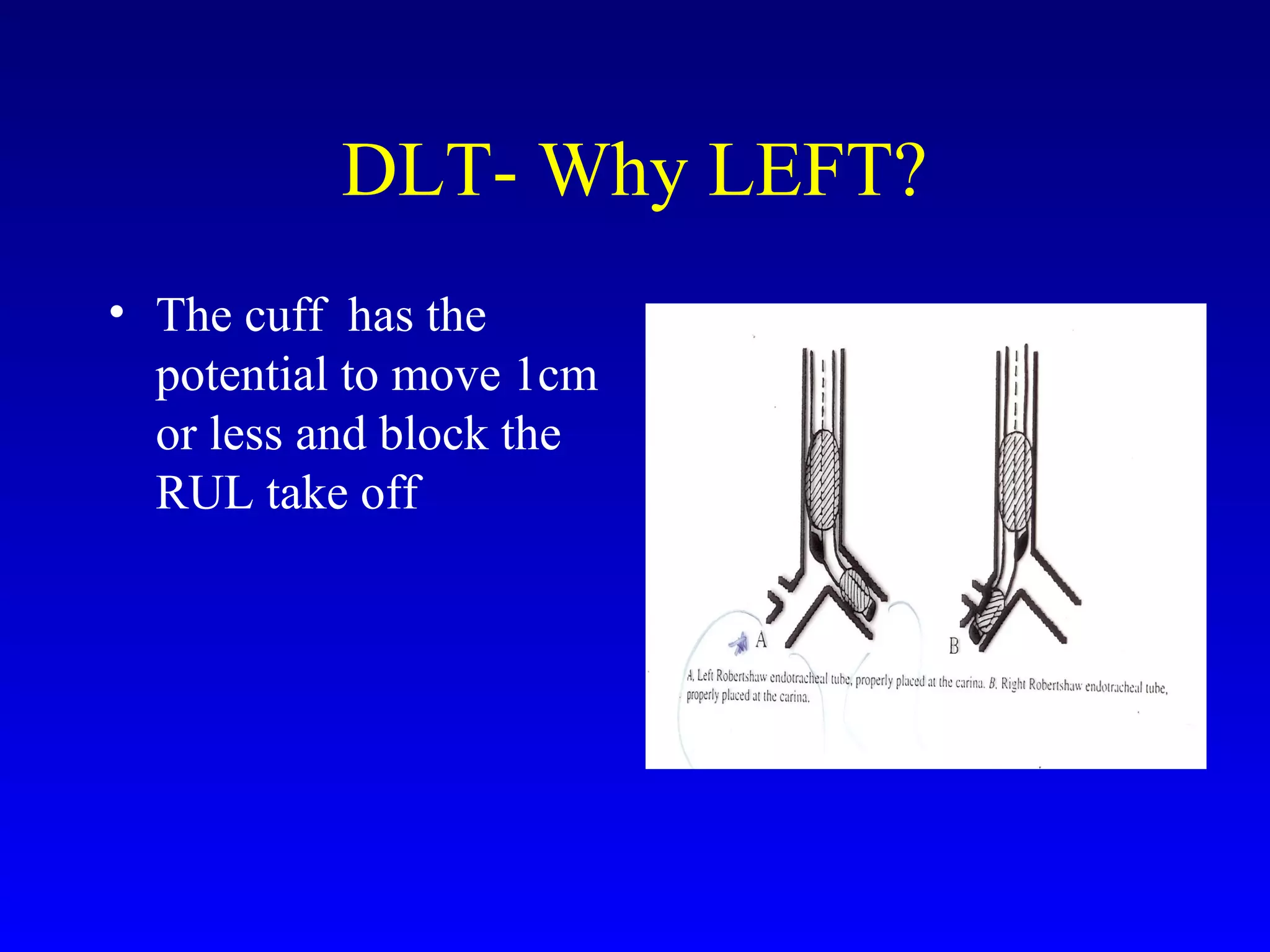 DLT- Why LEFT?
• The cuff has the
potential to move 1cm
or less and block the
RUL take off
 